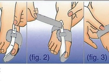 Вальгусний нічний бандаж-фіксатор для лікування деформації великого пальця на нозі valgus goodnight