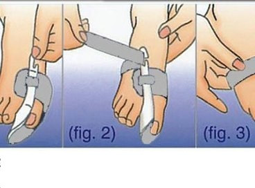 Valgus éjszaka merevítő reteszt kezelésére deformáció a nagylábujj valgus jóéjt