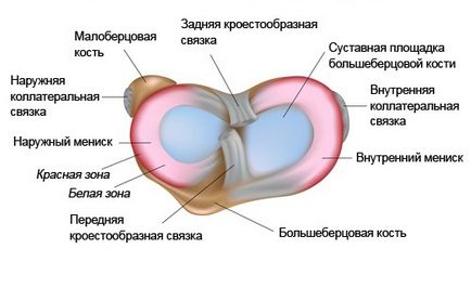 Minden, ami a mediális meniscus, degeneratív változások hátsó szarv (mediális) Minden, ami a mediális meniscus hátsó szarvának degeneratív elváltozások