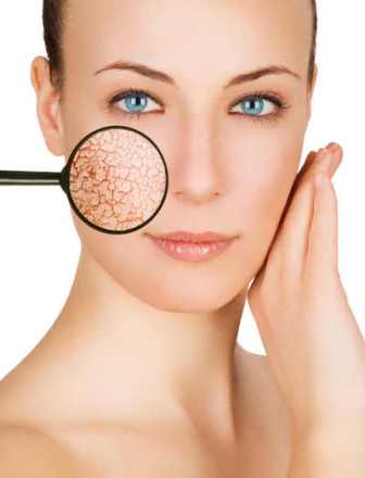 Allergia smink a szem és az arc a betegség kezelésében, fotók, és a tünetek az allergiás reakció