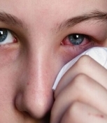 Алергія на шкірі види, причини, симптоми і засоби лікування