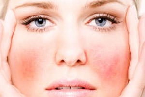 Алергія на обличчі