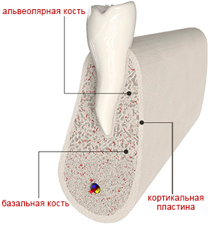 Implantare bazală, clinică de implantologie elvețiană - implantarea dinților în Sankt Petersburg