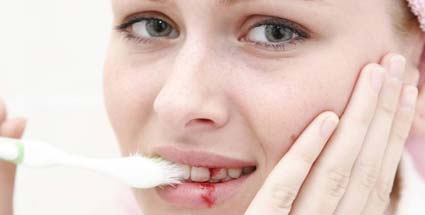 Mit lehet öblíteni a fogat terhes fáj az íny