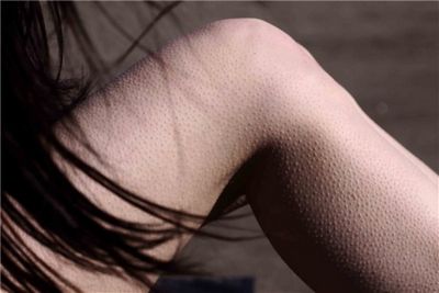 Гусяча шкіра »причини і методи лікування