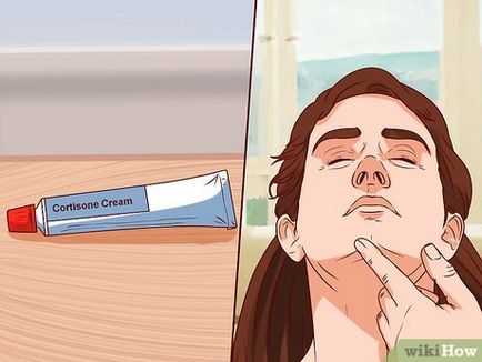 Cum să scapi de o cicatrice din cauza părului îngrădit