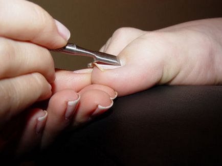 Як лікувати грибок нігтів в домашніх умовах (натуральні, народні методи лікування) 1