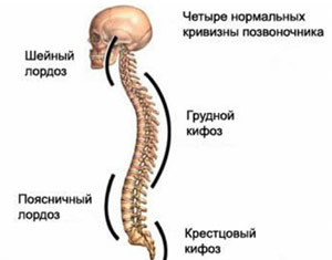 Лордоз грудного відділу хребта симптоми, причини, лікування