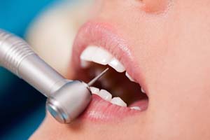 Módszerek fájdalommentes kezelés A fogbélgyulladás