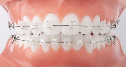 Ортодонтія - стоматологія - здорове покоління, Єкатеринбург