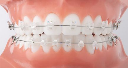 Fogszabályozás - Dental - Az egészséges generáció, Jekatyerinburg (fogszabályozás) Fogszabályozás - Dental - Az egészséges generáció, Ekaterinburg