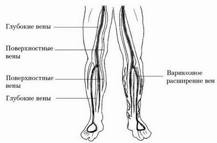 Чому болять ікри ніг і що цим робити 1