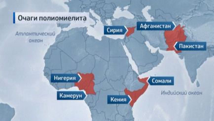 Simptomele poliomielitei, pericolul, vaccinările împotriva poliomielitei ca unic mijloc de prevenire