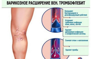 Чи допомагає яблучний оцет при варикозі, і як правильно його використовувати