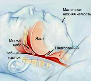 Причини виникнення хропіння, поява хропіння і методи лікування