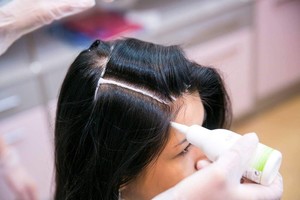 Проблема випадання волосся і її рішення - woman s day