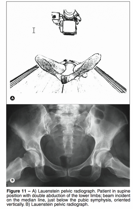 hip röntgenfelvételek alapján scopic ellenőrzés (közös) hip röntgenfelvételek alapján scopic ellenőrzés