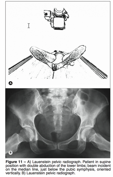 hip röntgenfelvételek alapján scopic ellenőrzés