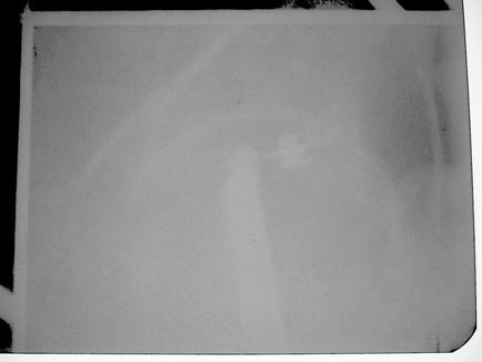 Radiografia articulației șoldului sub controlul skypic