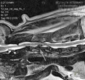 Discopatie cervicală la câini (hernie intervertebrală a coloanei vertebrale cervicale)