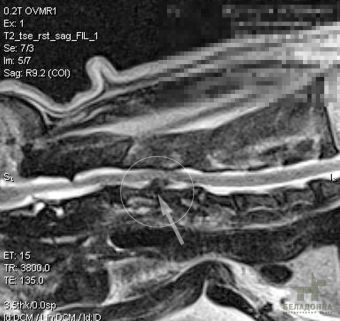 Шийна дископатия у собак (міжхребцева грижа шийного відділу хребта)