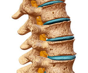 Osteochondroza cervicală și presiunea arterială