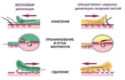 Шугарінг боляче чи ні, корисні поради