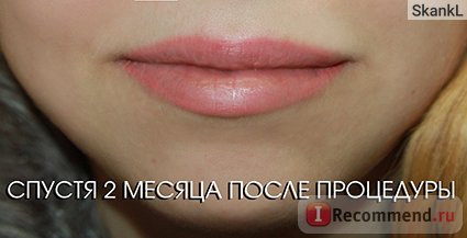 Татуаж губ - «короткий опис перших і наступних днів після татуажу губ