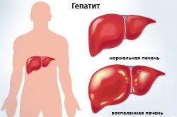 Vaccinarea împotriva hepatitei în instrucțiuni și diagrame, contraindicații