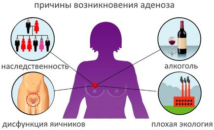Adenoză a glandelor mamare și a formelor sale (difuz, focal, local, sclerosed), tratament,
