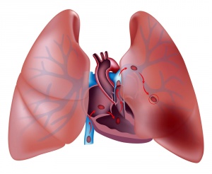 Anevrismul arterei pulmonare, este această boală periculoasă?