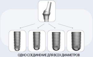 Axiom - egy egyszerű megoldás a komplex klinikai problémák, fogászati implantátumok, fogászati ellátás (csavarimplantátumokat) Axiom - egy egyszerű megoldás a komplex klinikai problémák, fogászati implantátumok, fogászati ellátás
