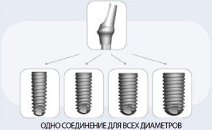 Axiom - soluția simplă a sarcinilor clinice complexe, implantarea dentară, îngrijirea dentară