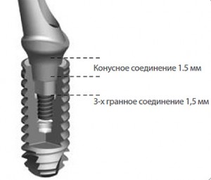 Axiom - egy egyszerű megoldás a komplex klinikai problémák, fogászati implantátumok, fogászati ellátás (csavarimplantátumokat) Axiom - egy egyszerű megoldás a komplex klinikai problémák, fogászati implantátumok, fogászati ellátás