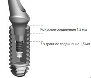 Axiom - soluția simplă a sarcinilor clinice complexe, implantarea dentară, îngrijirea dentară