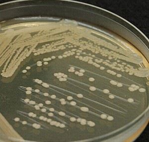 Bacillus - proprietăți biochimice ale bacilului de fân, cultivare și aplicare