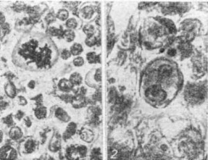 Diseases of Szarvasmarha, tumorok (például daganatok nevezzük) Állattenyésztés betegség, tumorok
