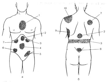 Durerea în abdomen