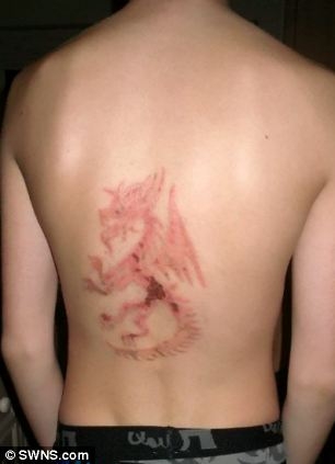 Брати отримали страшні опіки від тимчасової татуювання хною, зробленої в Єгипті, умкра