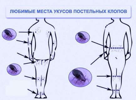 Колкото по-опасни грешки ухапвания на хора