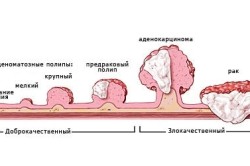 Ce să faceți pe cervixul cosului