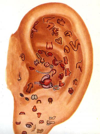 Діагностика хвороб по вухах (анатолій Ревуцький)