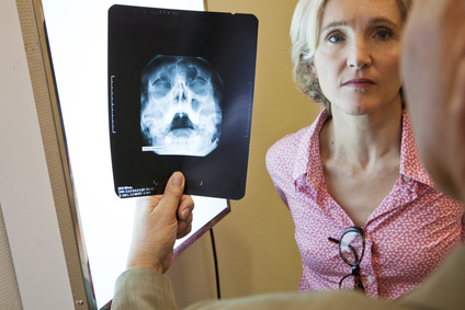 Az endoszkópos arcüreg sinusotomy gold standard műtéti kezelés arcüreggyulladás