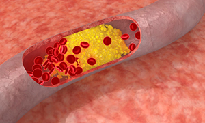 Isotretinoin - recenzii, instrucțiuni, utilizare