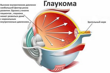 Як позбутися від червоних судин на білках очей причини і лікування з фото