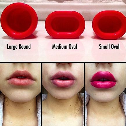 Hogyan lehet növelni az ajkakat szilikonmentes