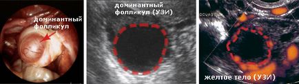 Cum să vezi foliculii în uter - foliculometria și trăsăturile acesteia