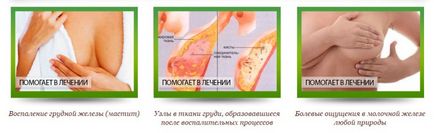 Китайські пластирі від мастопатії huaxin breast plaster