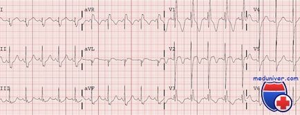 Clinica, diagnosticul traumatismului cardiac abrupt