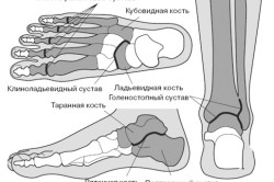 Tratamentul artritei piciorului la domiciliu